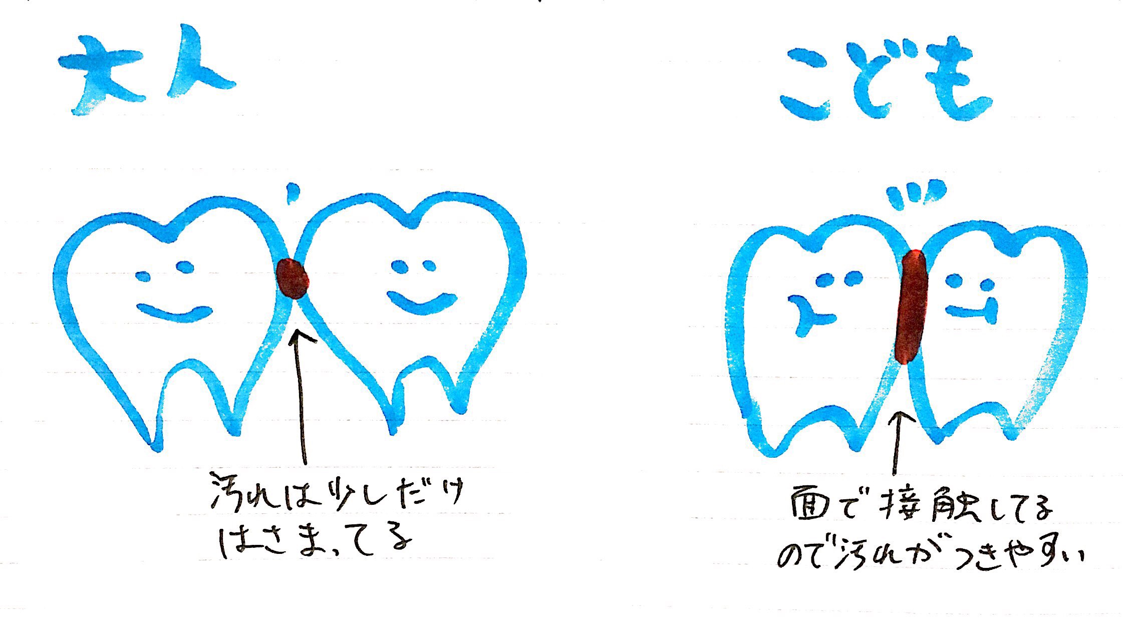 小児の虫歯の特徴について かさはら歯科医院 宮城県仙台市の歯医者