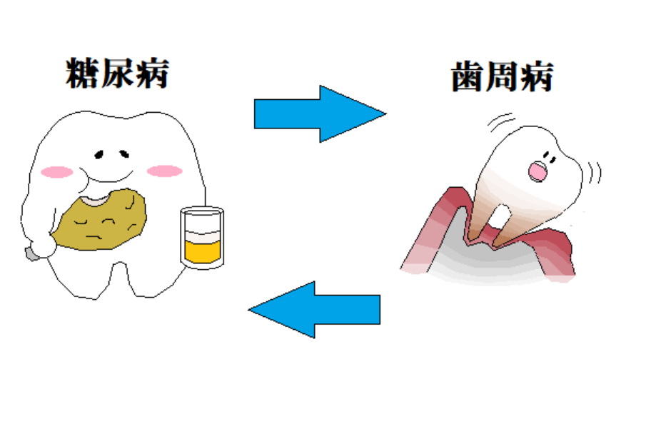 歯周病と糖尿病の関係 かさはら歯科医院 宮城県仙台市の歯医者